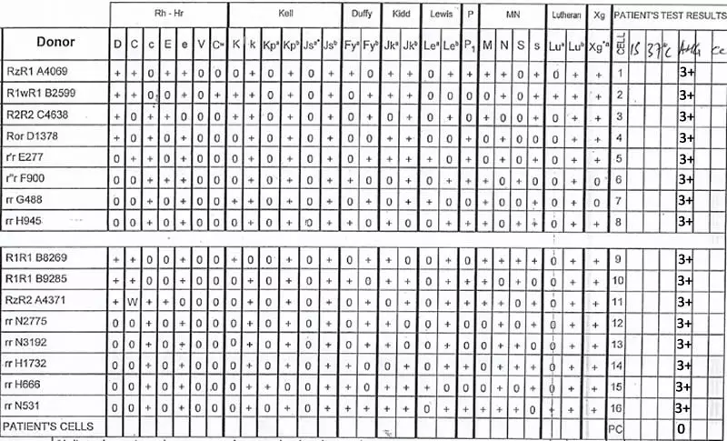 An Unusual Blood Group LearnHaem Haematology Made Simple